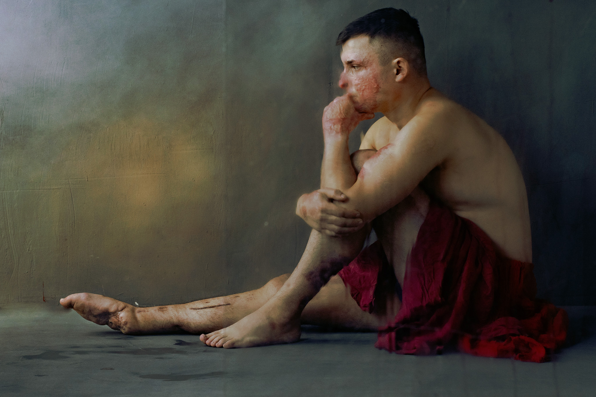 Wounded Beauty: Marta Syrko's Portraits of Ukrainian Soldiers